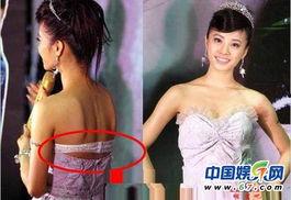 女明星拉稀,女明星拉稀背后的健康警示